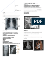 Guía práctica radiografía aneurisma carotídeo diagnóstico