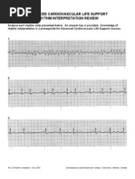 Bifascicular Block - LITFL - ECG Library Diagnosis | PDF ...