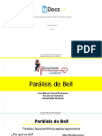 Paralisis Facial1