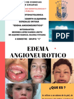 Edema Angioneurotico