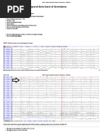 Midline Theta Rhythm (Ciganek) Overview | PDF