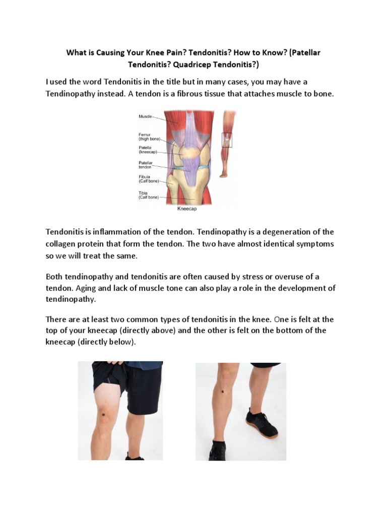 5D. What is Causing Your Knee Pain Tendonitis How to Know Patellar