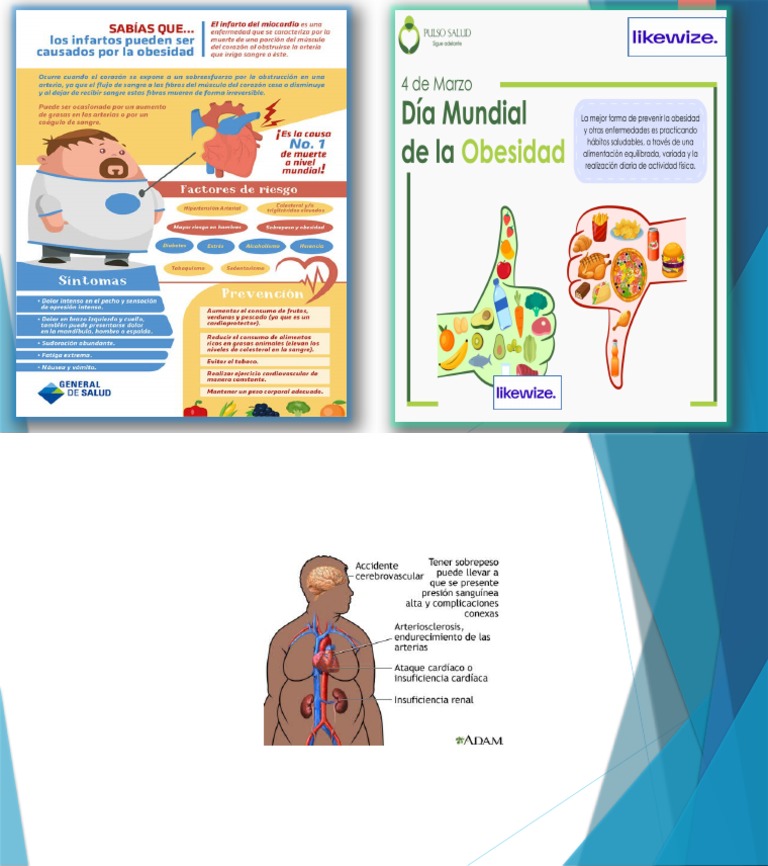 Boletin Informatuvo Obesidad | PDF