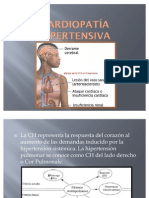 Cardiopatía hipertensiva