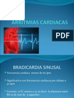 Arritmias Cardiacas1