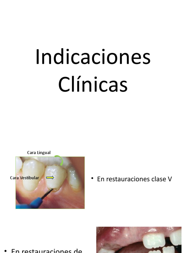 Compomeros | PDF