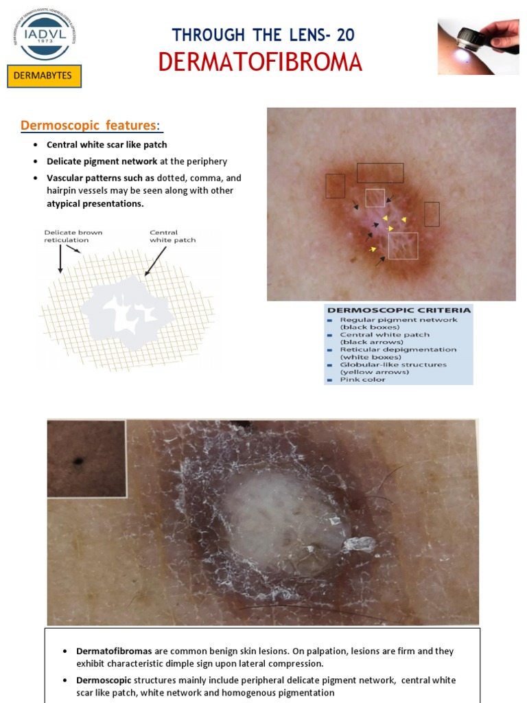 Through The Lens - 20 | PDF