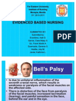 Bell's Palsy Ebn