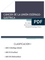 Cancer de La Union Esofago-Gastrica