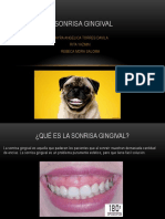 Sonrisa Gingival