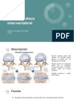 Hernia de Disco Intervertebral 
