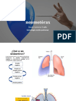 Neumotórax