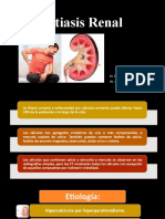 Litiasis Renal