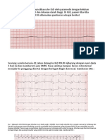 Case Ekg