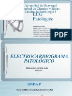 Grupo 11 - ECG Patologico