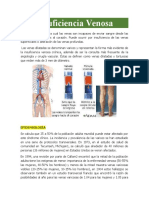 Insuficiencia Venosa Trabajo