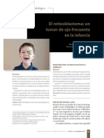 El Retinoblastoma: Un Tumor de Ojo Frecuente en La Infancia: Caso Radiológico