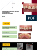 Estudio de Los Estadios Regresivos de Los Dientes Clinica