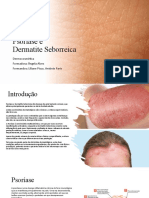 Psoríase vs Dermatite Seborreica: as principais diferenças