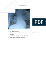 Tugas Radiologi 1