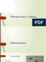 Quistes y Fibromas Laxos