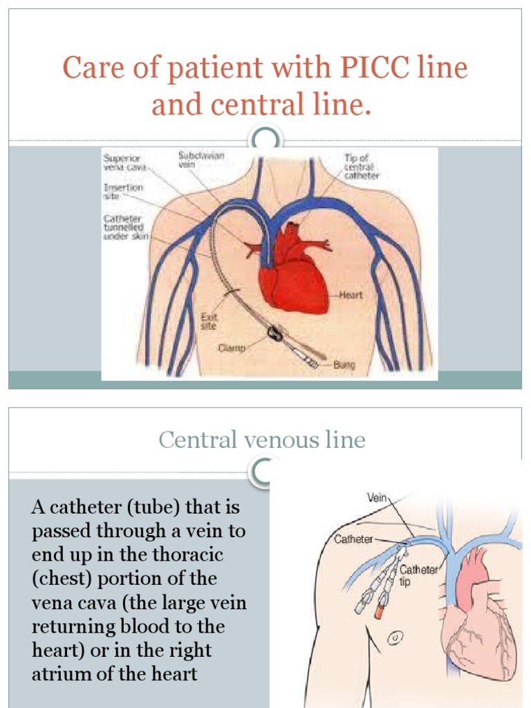 Care of Patient With PICC Line and Central | PDF