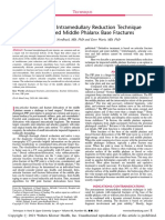 Percutaneous Intramedullary Reduction Technique For Impacted Middle Phalanx Base Fractures