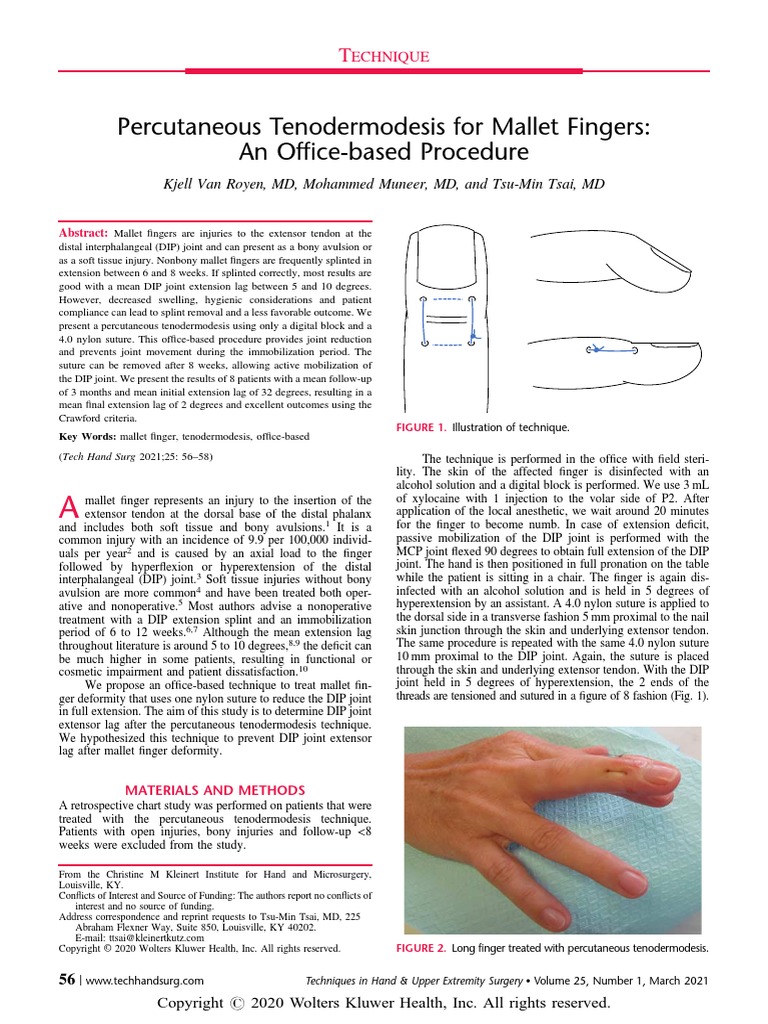 Percutaneous Tenodermodesis for Mallet Fingers an Office Based