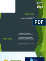 Arritmias cardiacas irregulares