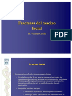 Fracturas Faciales