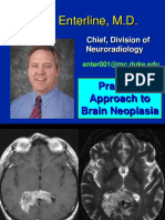 34 - Brain Neoplasia