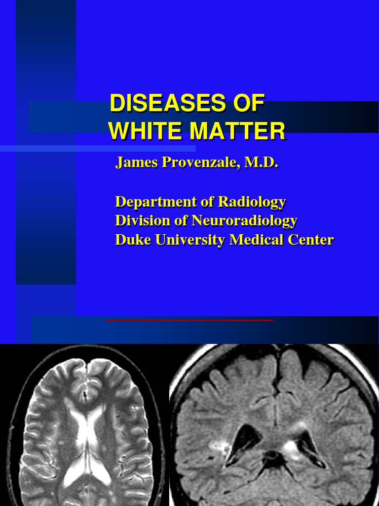 Overview of White Matter Diseases | PDF | Multiple Sclerosis | Myelin
