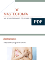 tiposdemastectoma-130103171334-phpapp02