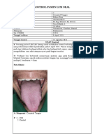 Fahrur Rozi - 20194020077 - Kontrol Online Lesi Oral - Crenated Tongue