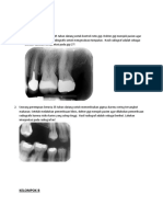 Radiografi Tumpatan