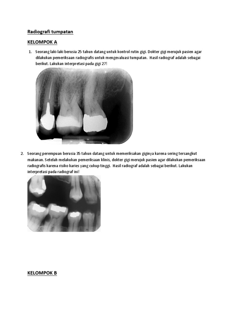 Radiografi Tumpatan | PDF