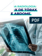 Ebook ABC Da Radiologia Raio X Torax Abdome