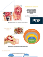 Ruptura Uterina
