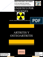 Artritis Osteoartritis