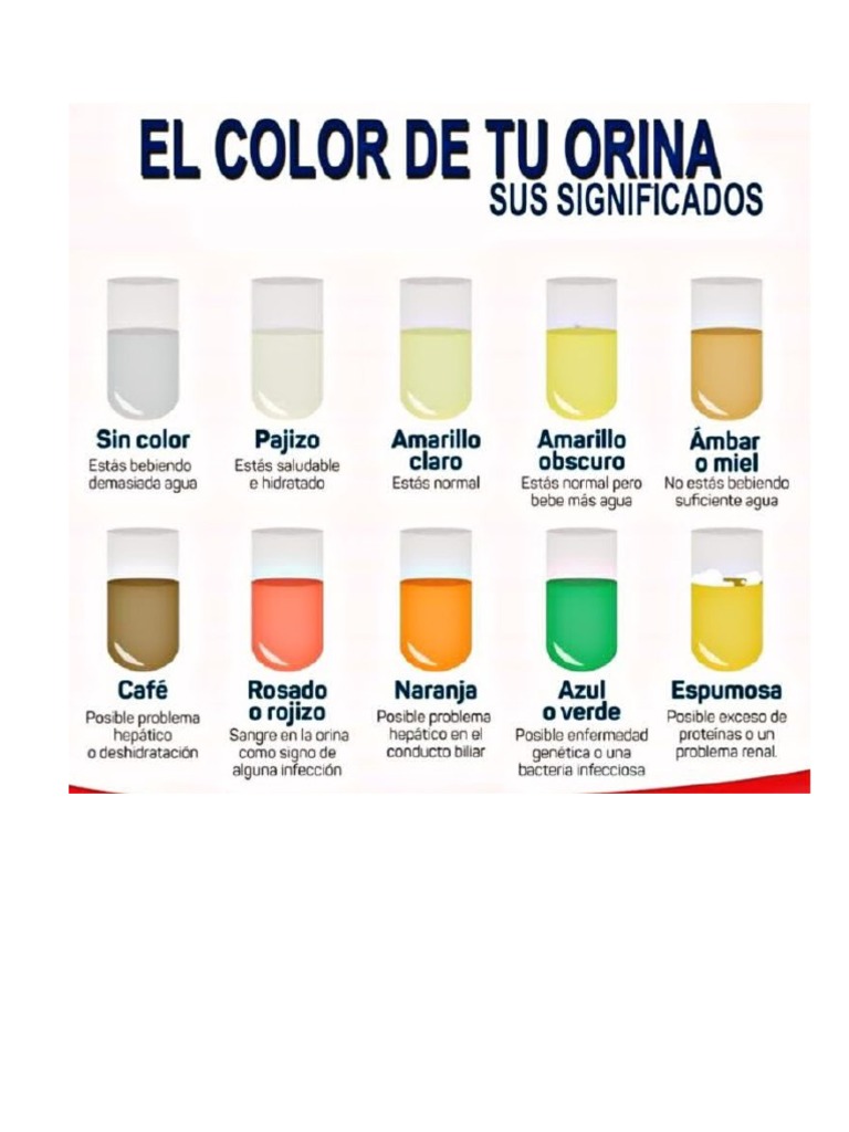 Color de Orina PDF