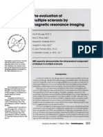 MRI superbly demonstrates MS lesions