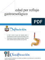 ERGE: Enfermedad por reflujo gastroesofágico