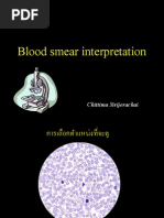 Download Blood Smear interpretation by Rapid Medicine SN59431882 doc pdf