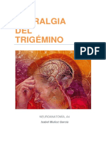Neuralgia del trigémino: causas, síntomas y tratamiento