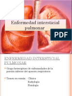 Enfermedad pulmonar intersticial (EPI