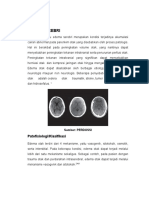 Edema Cerebri M. Anugrah Samudra - Revisi