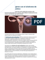 Tips para Mujeres Con El Síndrome de Ovario Poliquístico