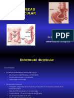 Enfermedad Diverticular