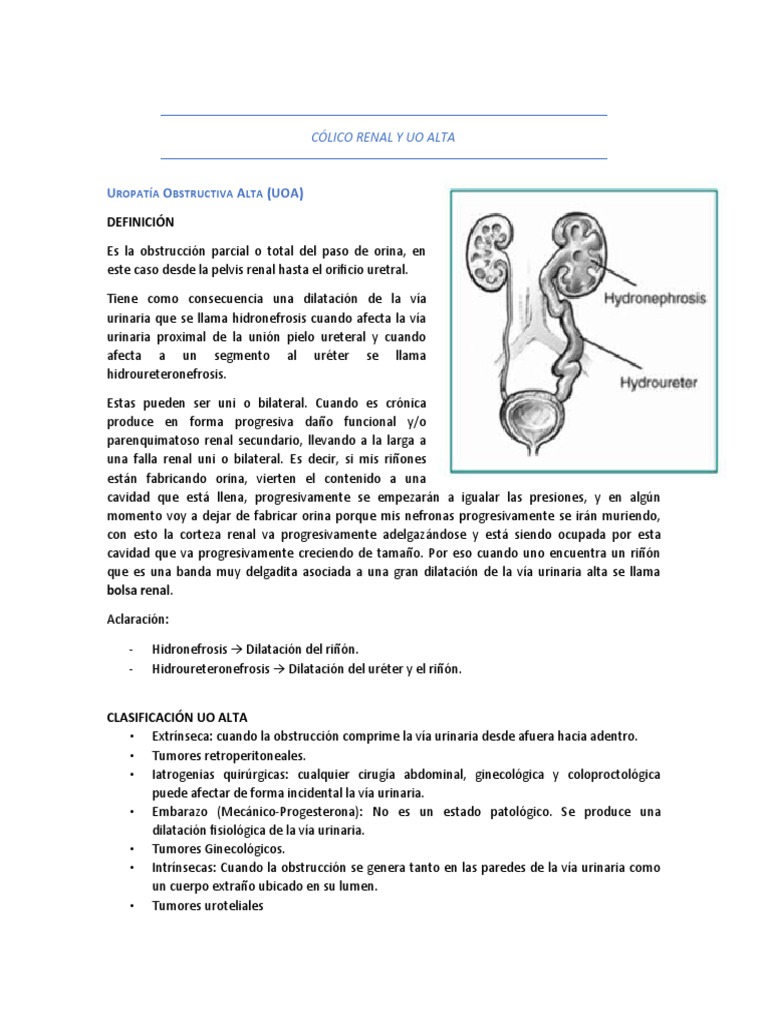 3 Cólico Renal y Uo Alta | PDF | Sistema urinario | Riñón
