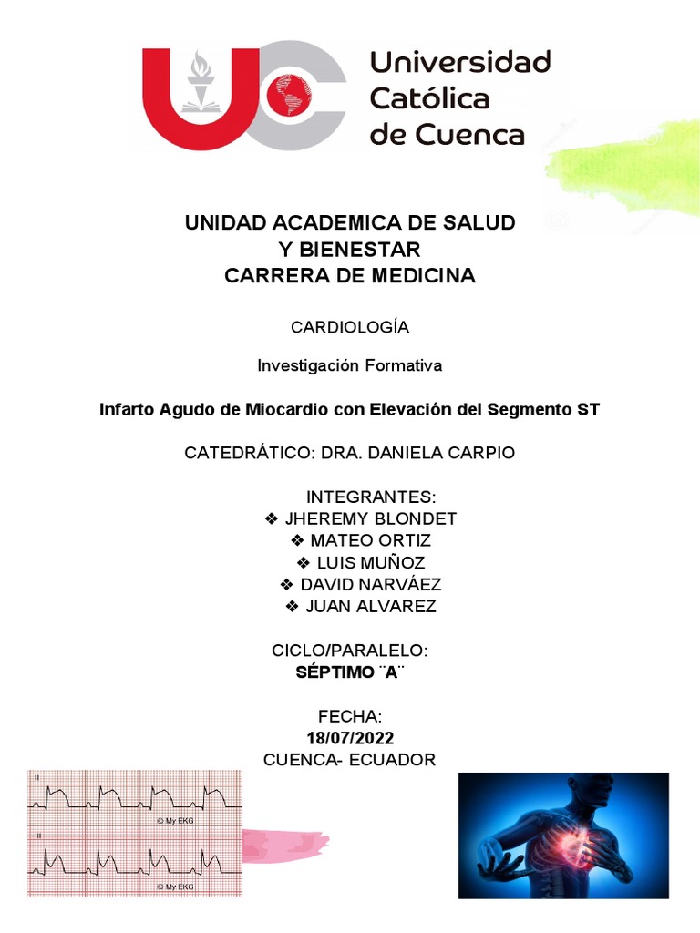 Infarto Con ST | PDF | Infarto de miocardio | Electrocardiografia